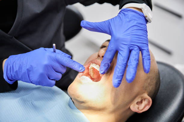 Best Emergency Dental Care for Broken or Chipped Teeth in Clarksville, IN